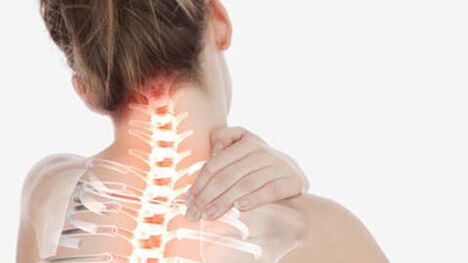 The cervical spine osteochondrosis